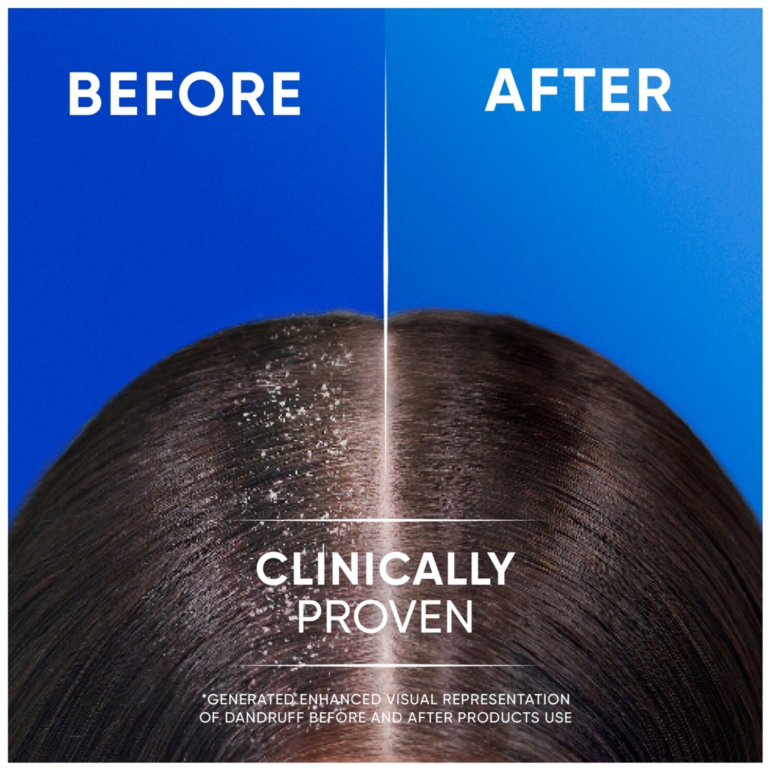 Head & Shoulders 2 in 1 Shampoo and Conditioner Image 5