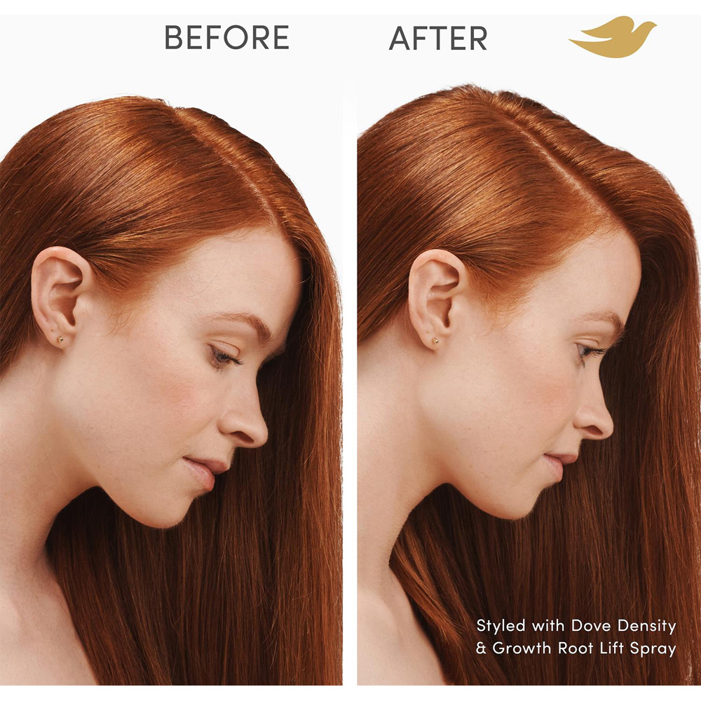 Dove Scalp+Hair Therapy Density and Growth Root Lift Biotin Hair Spray 100ml 12 Pack Image 5